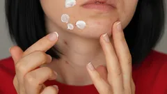 Reine Haut ohne Pickel und Flecken? Das ist möglich!
